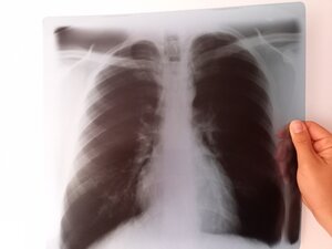 Bild vergr&ouml;&szlig;ern: Röntgenaufnahme